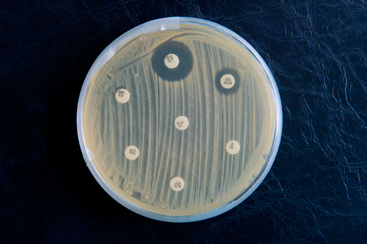 La resistencia a los antibióticos: una pandemia silenciosa