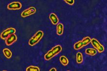 Cómo los gérmenes moldean la historia Yersinia Pestis